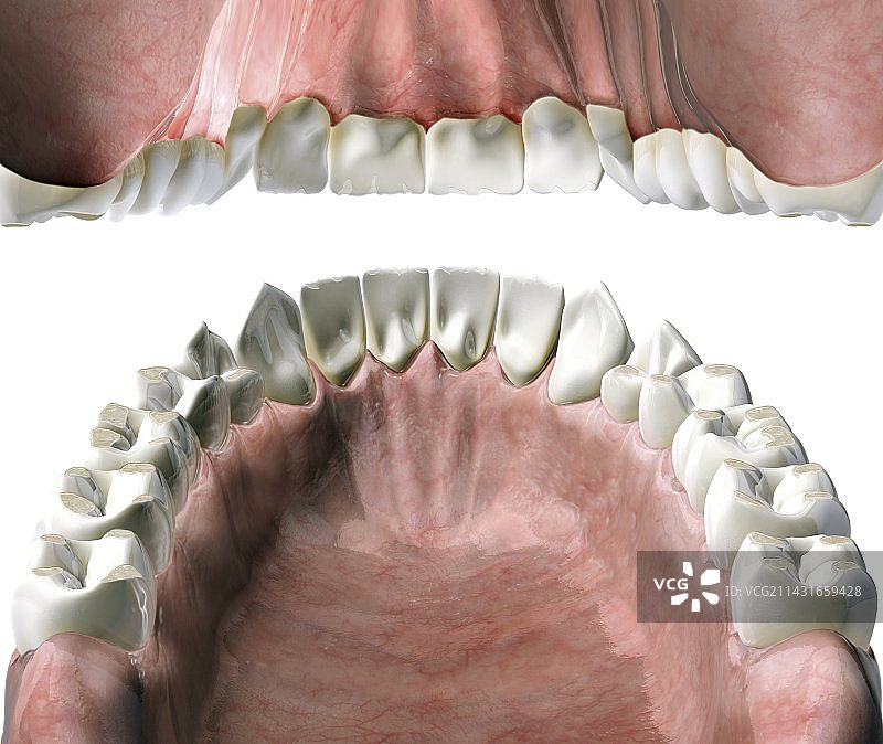牙齿酸蚀症医学插图图片素材
