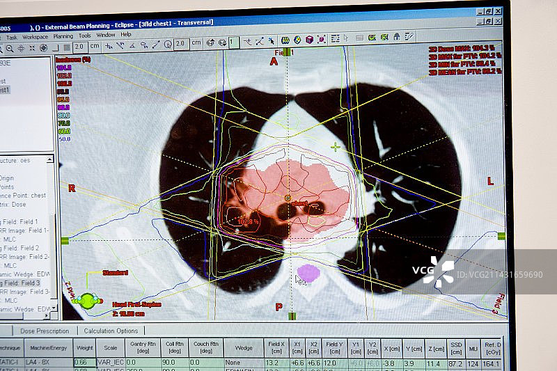 癌症治疗计划截图图片素材