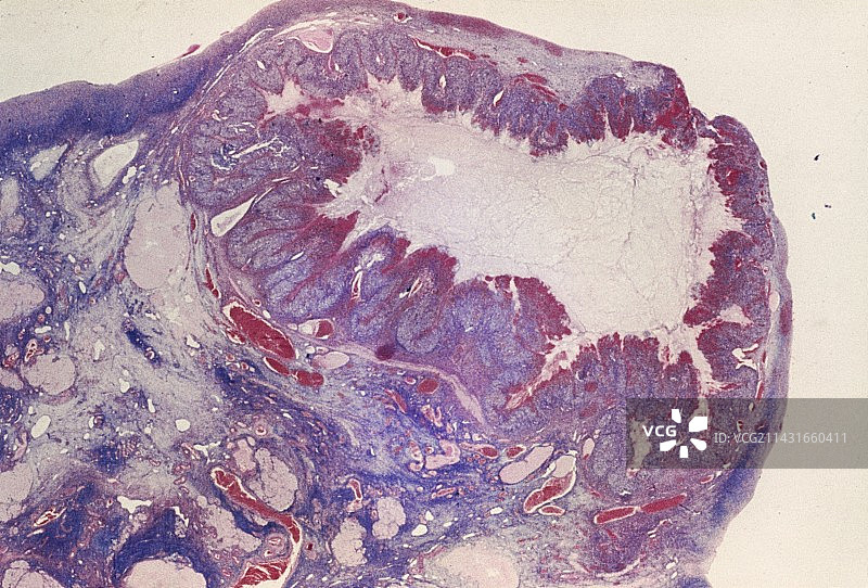 卵巢黄体截面的光学显微镜照片图片素材