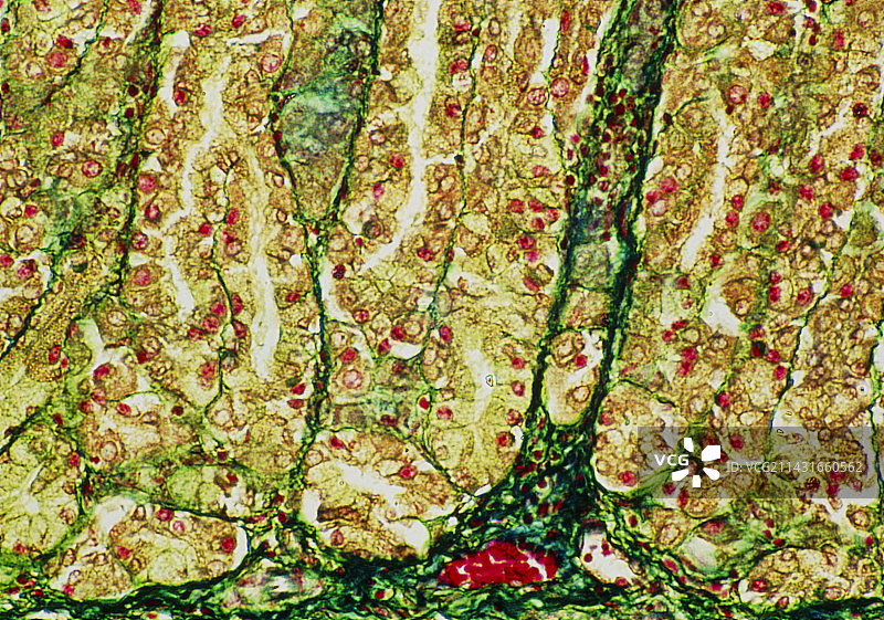 胃黏膜的光学显微镜照片图片素材