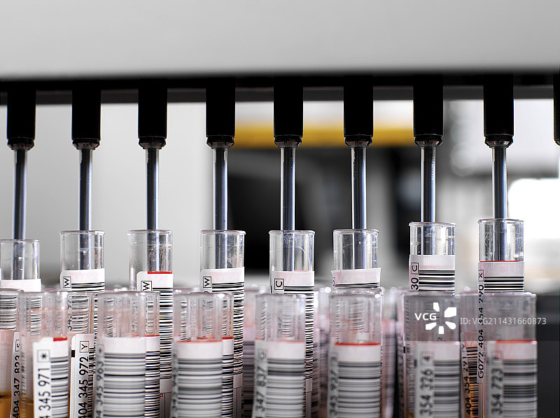 血液分析图片素材