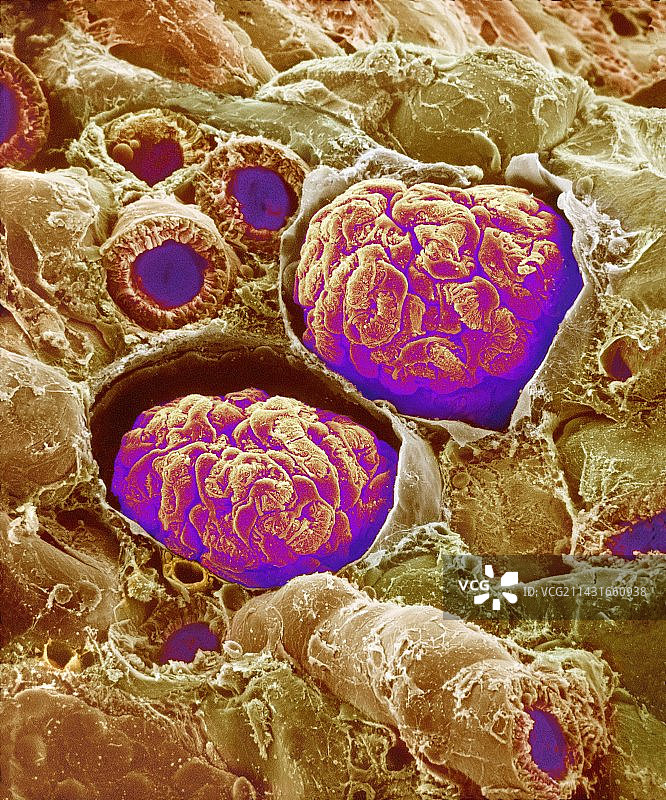 肾小球扫描电镜图图片素材