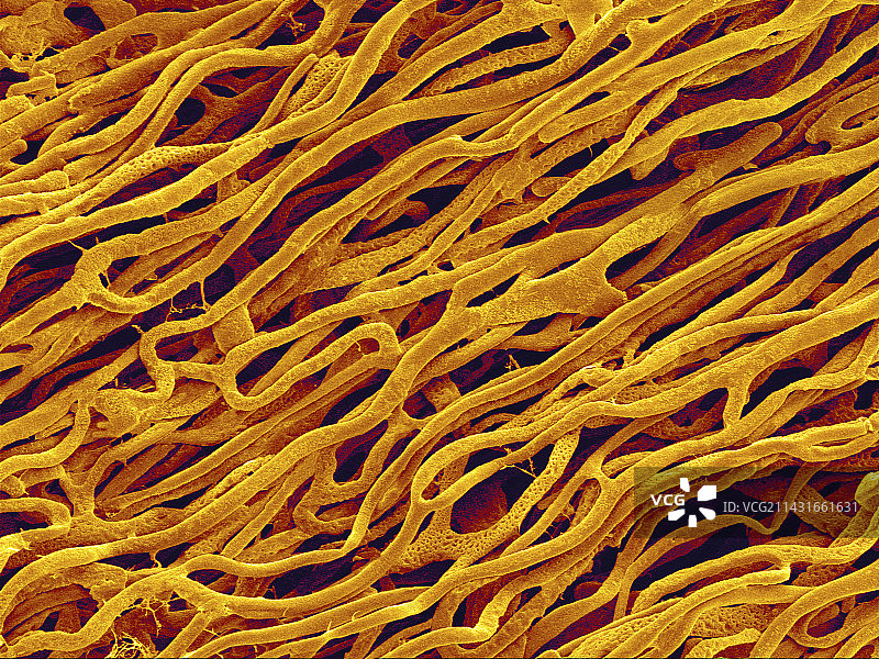 心肌血管，扫描电镜图图片素材