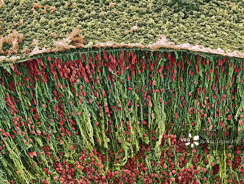 胎儿脑细胞扫描电镜图图片素材