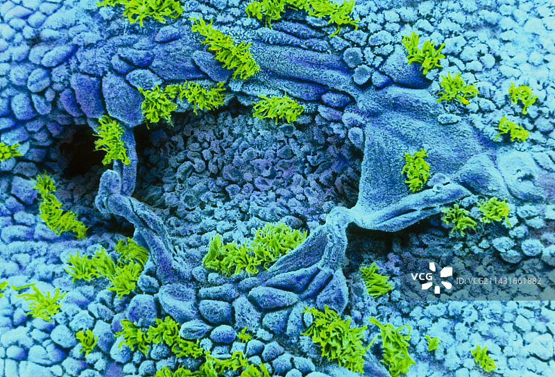 彩色扫描电镜下的子宫壁（早期增殖）图片素材