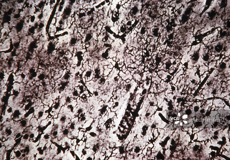 小胶质细胞图片素材