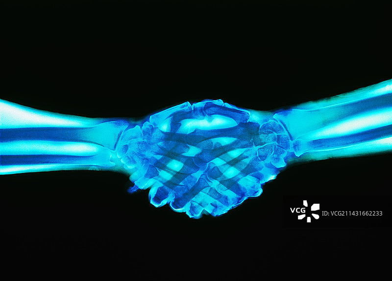 握手的彩色X光片图片素材