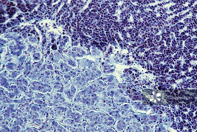 肾上腺图片素材
