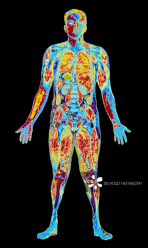 人体解剖：男性身体切面（正面）图片素材