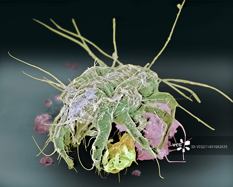 尘螨，扫描电子显微镜图片素材