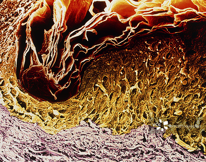 皮肤切片扫描电镜彩色图像图片素材