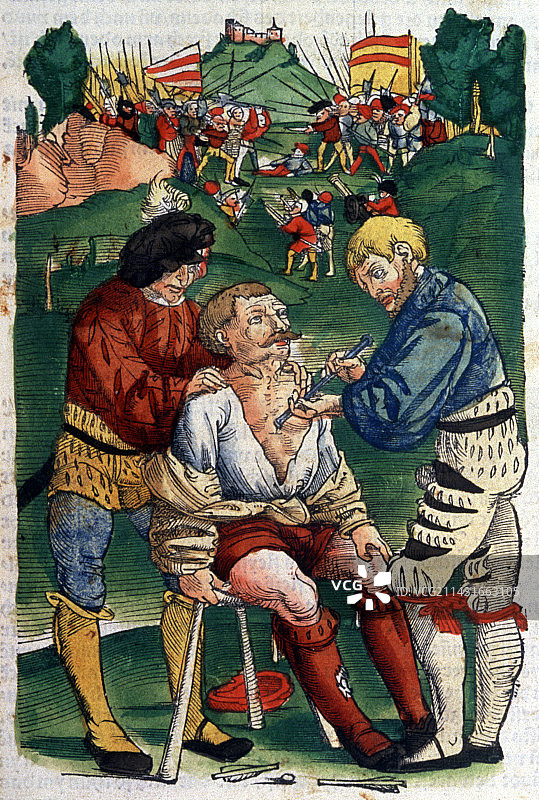 1540年的战场外科手术图片素材