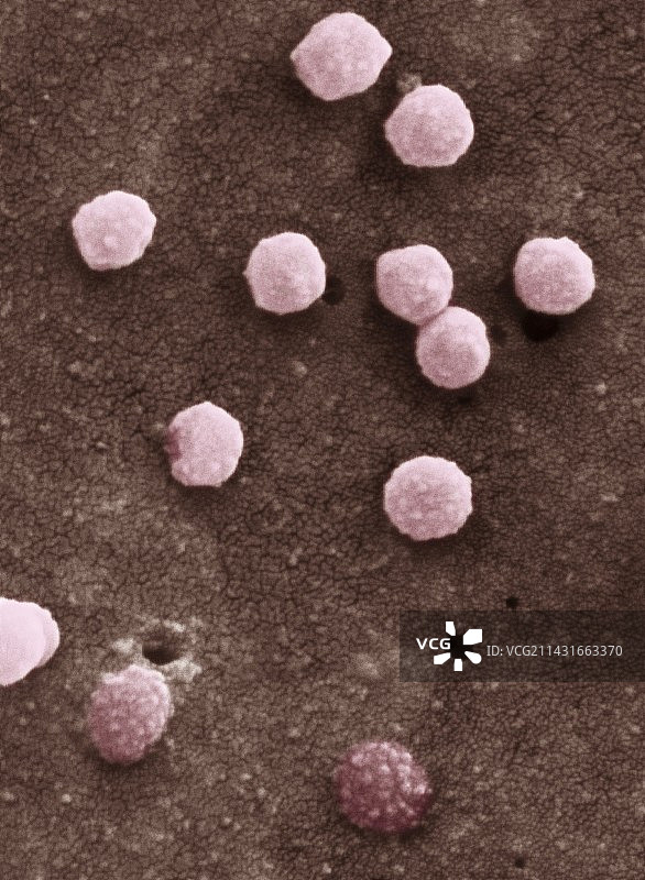 感染艾滋病毒的细胞，扫描电镜图图片素材