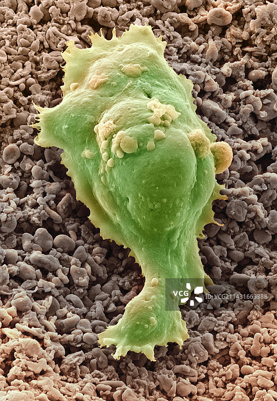 人类胚胎干细胞扫描电镜图图片素材