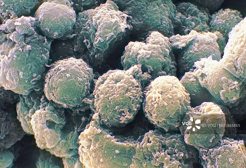 单核细胞白细胞扫描电镜图图片素材