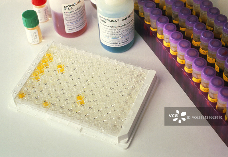 丙型肝炎病毒抗体的Monolisa EIA测试图片素材