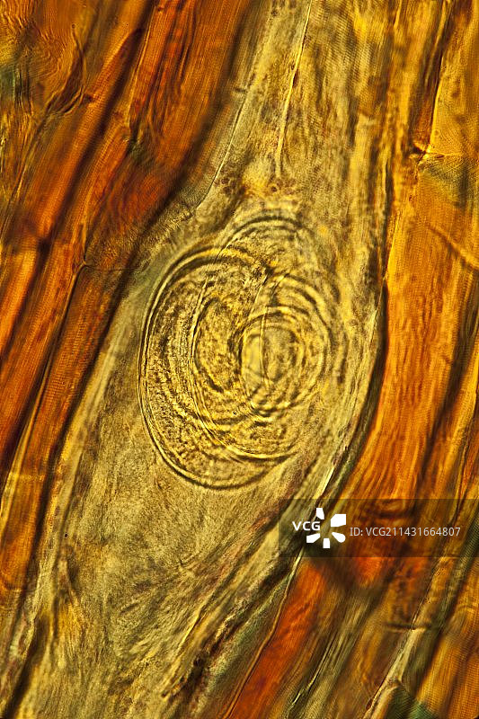 线虫幼虫囊肿显微照片图片素材