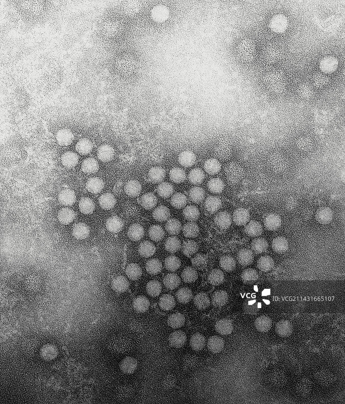 甲型肝炎病毒颗粒的透射电镜照片图片素材