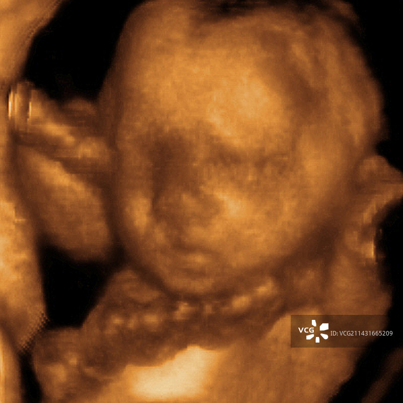 胎儿3D超声波扫描图片素材