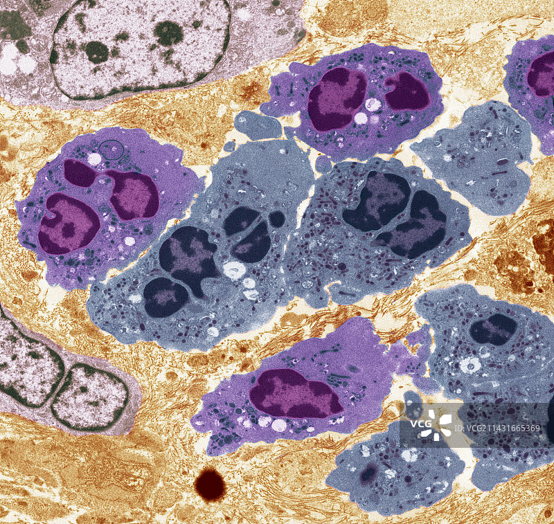 中性粒细胞白细胞TEM图片素材