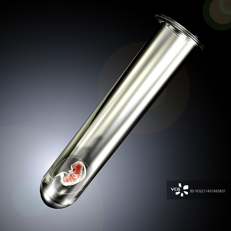 试管婴儿图片素材