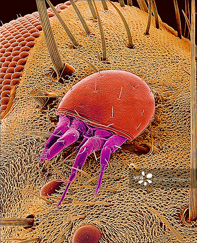 苍蝇身上的螨虫，扫描电镜图片素材