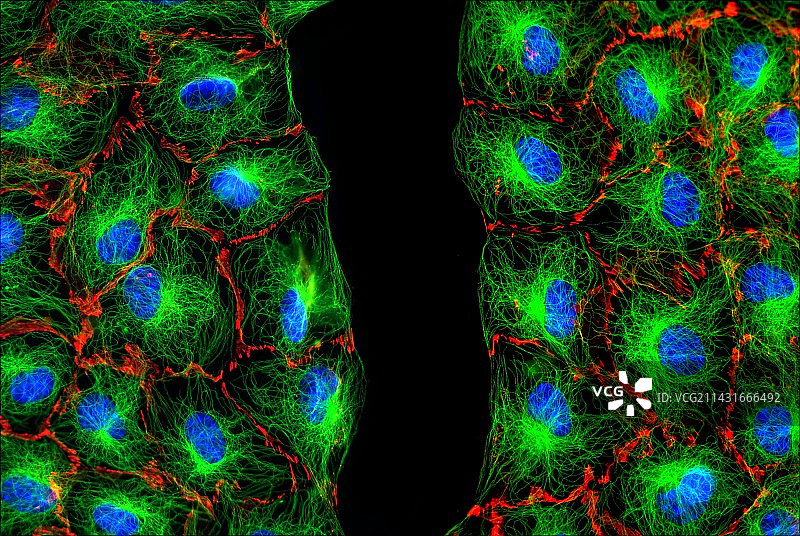 成纤维细胞荧光显微照片图片素材