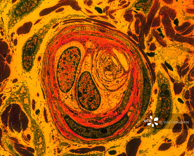 阴茎中感觉神经末梢的彩色透射电镜图图片素材