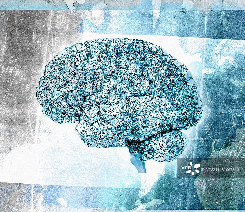 老龄化的大脑图片素材
