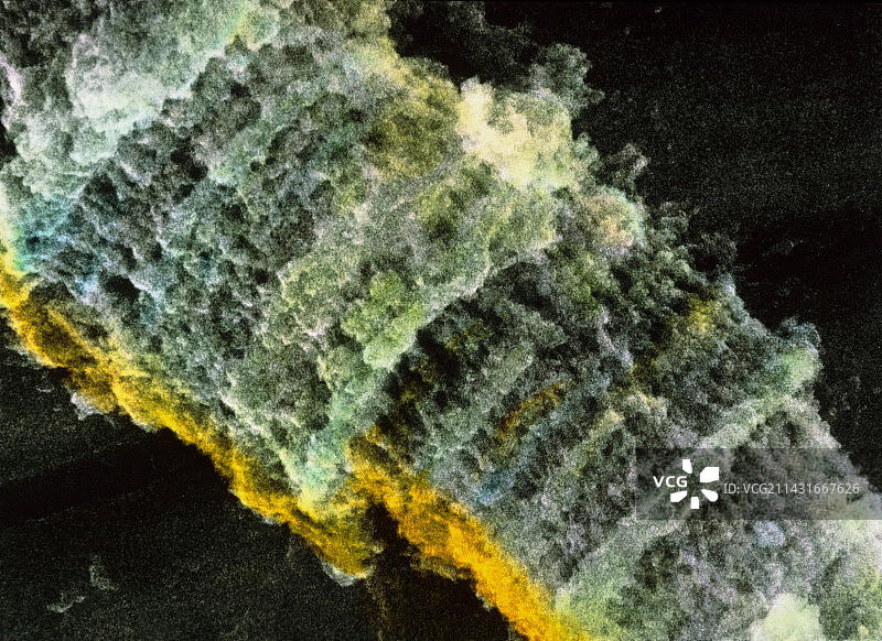 果蝇巨大（多线）染色体的扫描电镜照片图片素材