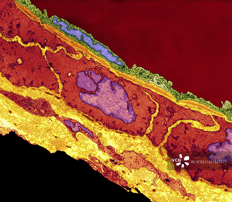 冠状动脉小动脉TEM图片素材