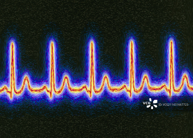 健康心脏心电图的计算机艺术作品图片素材