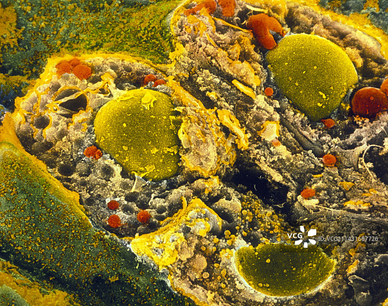 肾上腺分泌细胞的彩色扫描电镜图图片素材