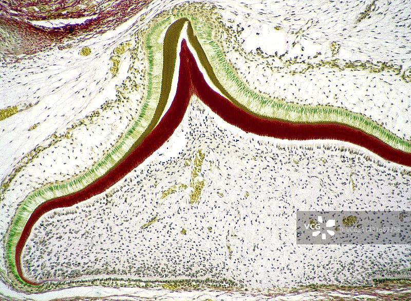 牙齿发育显微照片图片素材