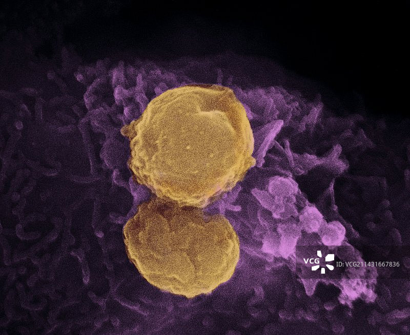 寄生原生动物，扫描电子显微镜图片素材