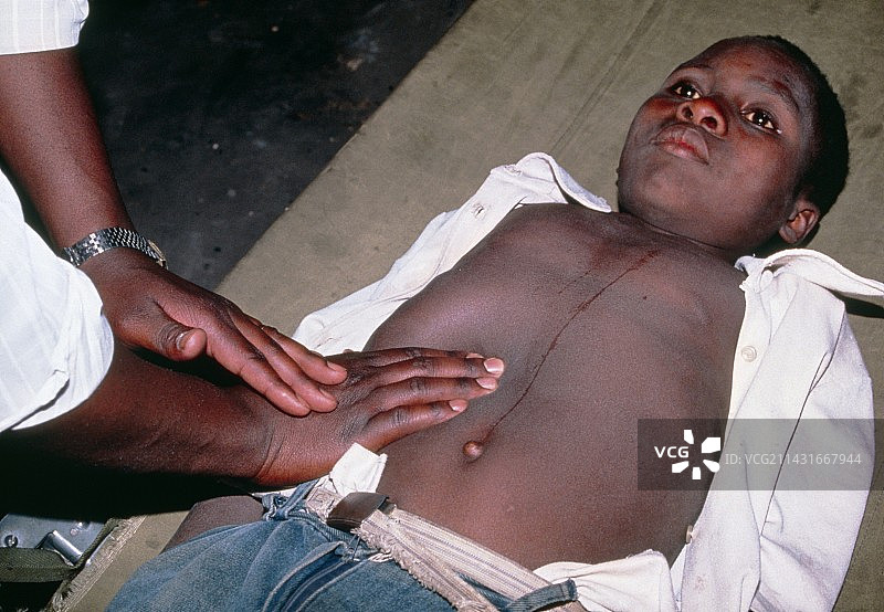 卫生工作者检查男孩是否患有血吸虫病图片素材