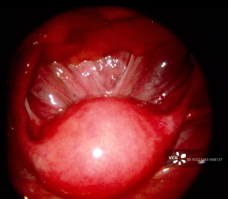 人类子宫内窥镜图像图片素材