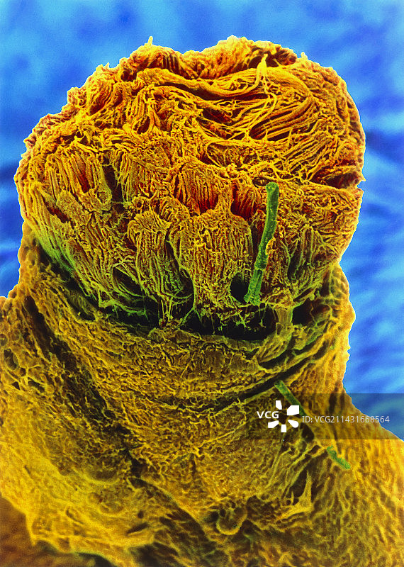 神经纤维与神经束膜彩色扫描电镜图图片素材