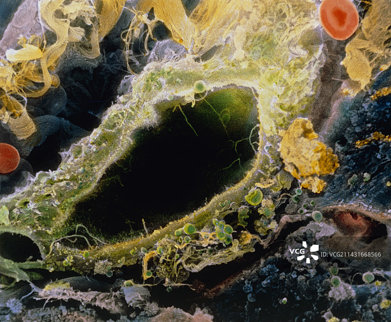 肝脏内胆管的伪彩色扫描电镜图图片素材