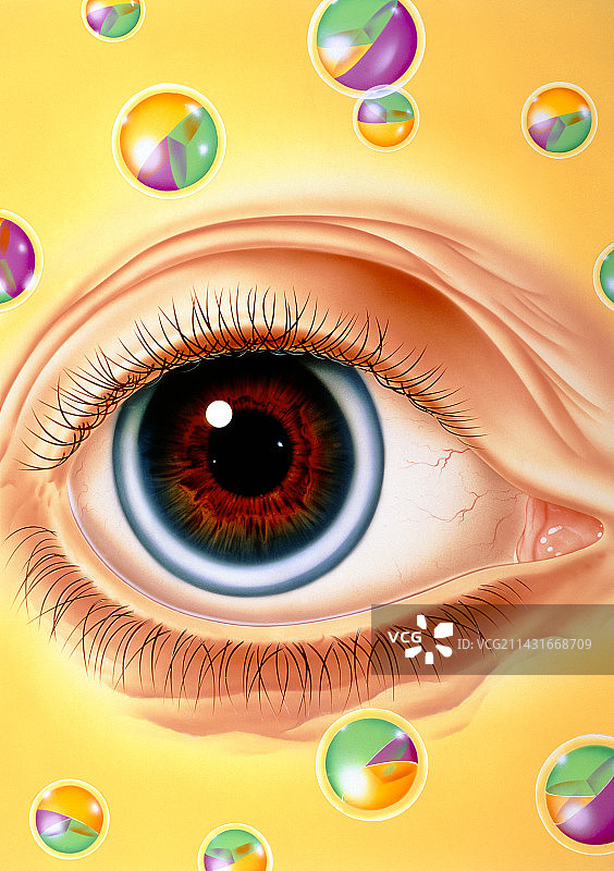老年环眼部疾病插画图片素材