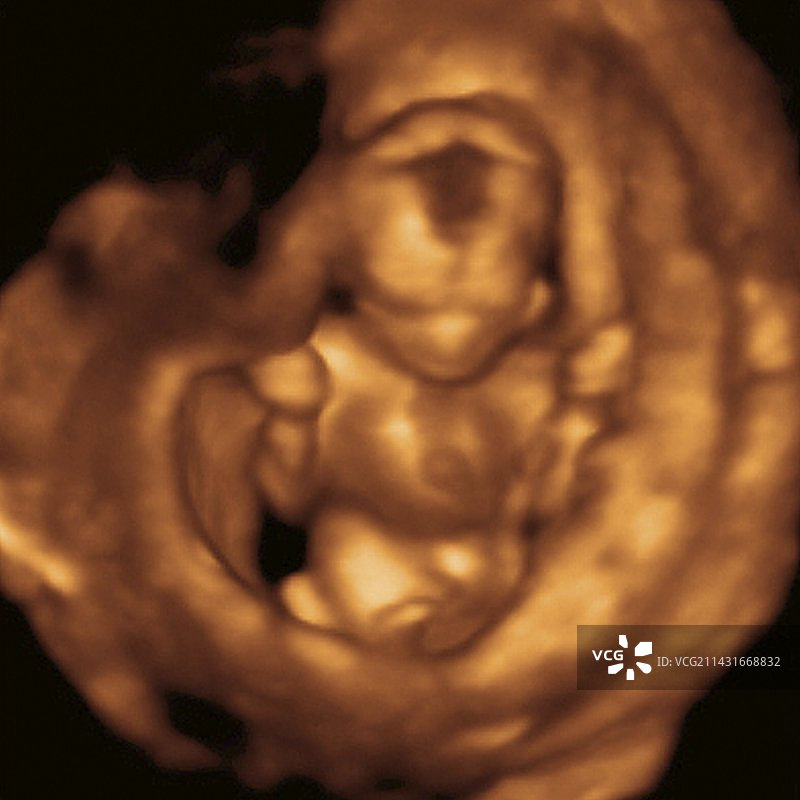 胎儿3D超声波扫描图片素材