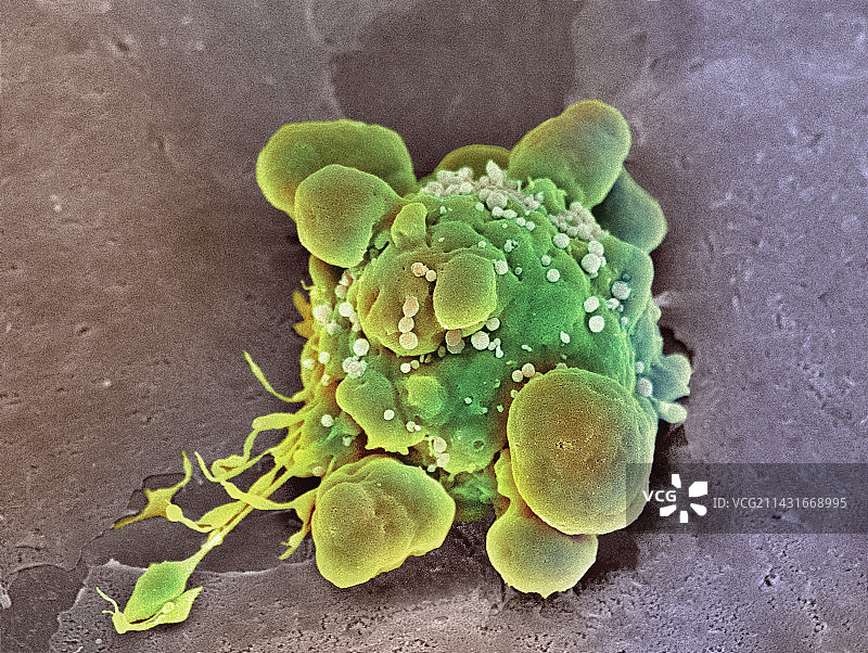 癌细胞凋亡，扫描电子显微镜图片素材