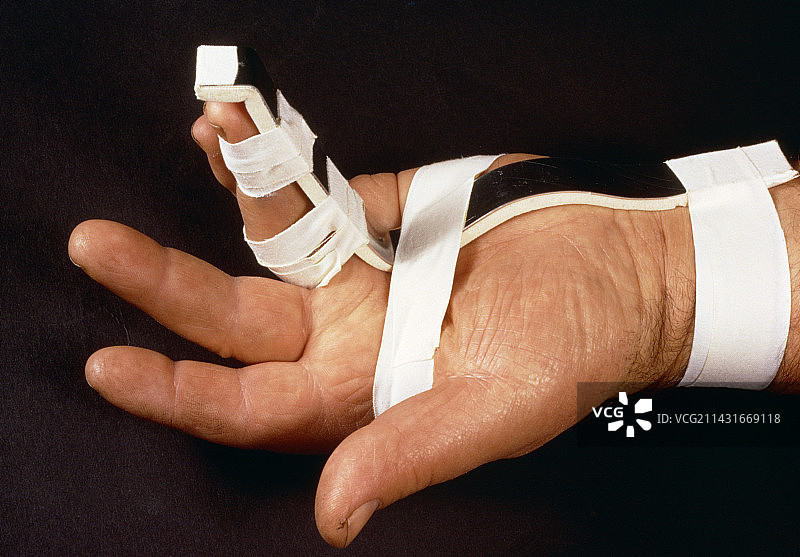 骨折手指上的夹板图片素材