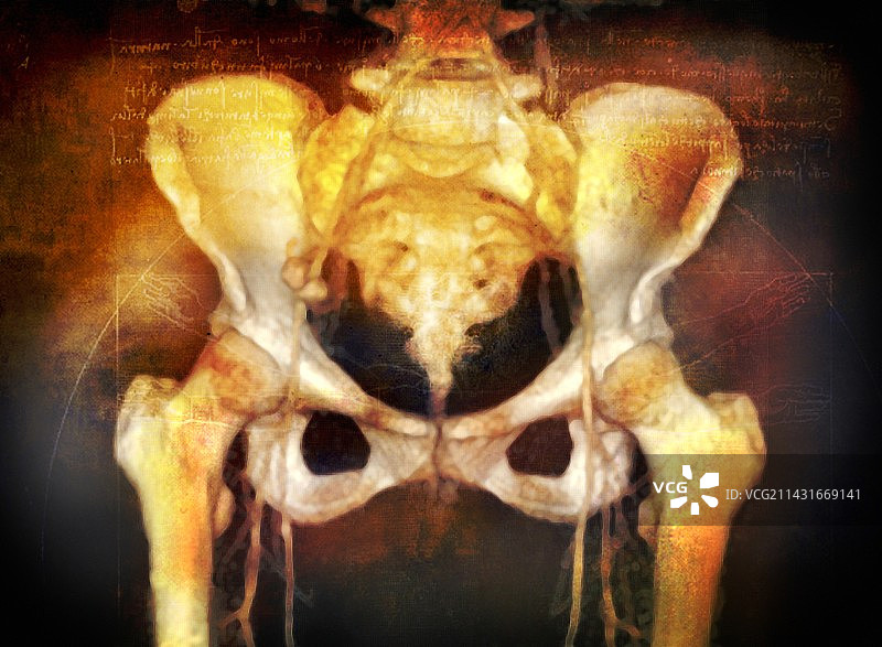 彩色女性盆骨3D CT扫描图片素材