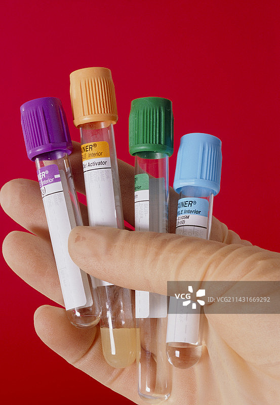 戴手套的手拿着各种血液样本瓶图片素材