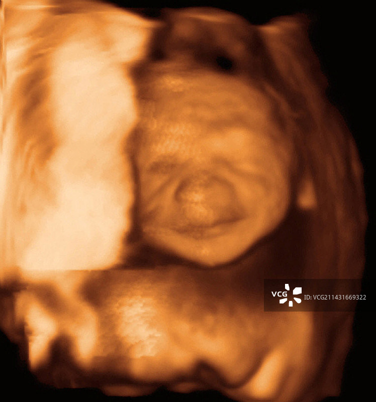 胎儿3D超声波扫描图片素材