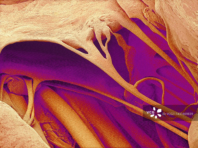 心脏瓣膜和腱索，扫描电子显微镜图图片素材