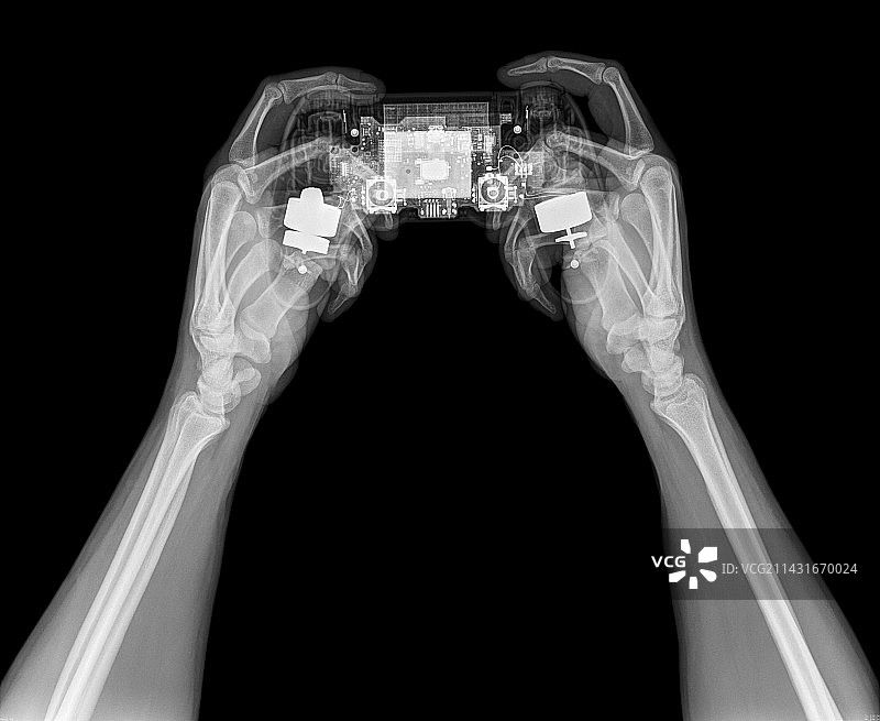 Playstation游戏手柄X光图图片素材