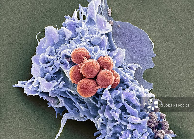 真菌孢子的吞噬作用，扫描电镜图片素材