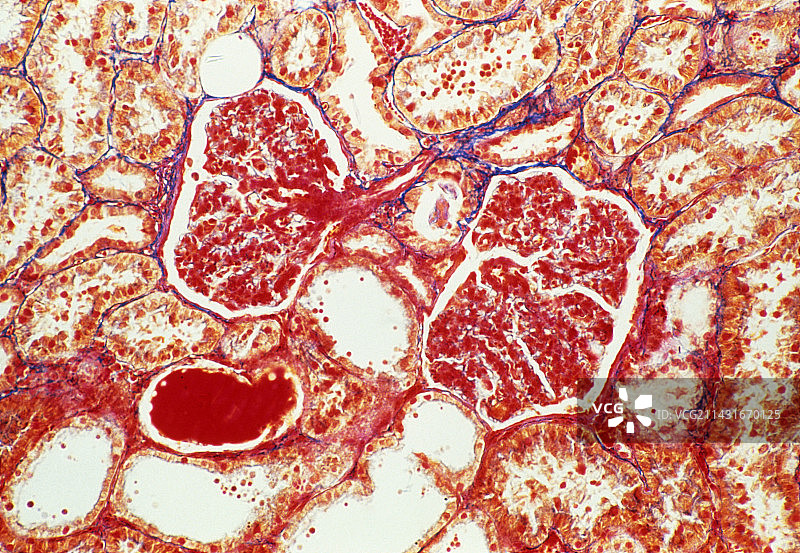 肾脏切片中肾小球和肾小管的光学显微镜图像图片素材